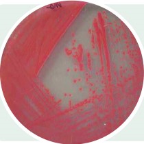 假单胞菌 假单胞菌