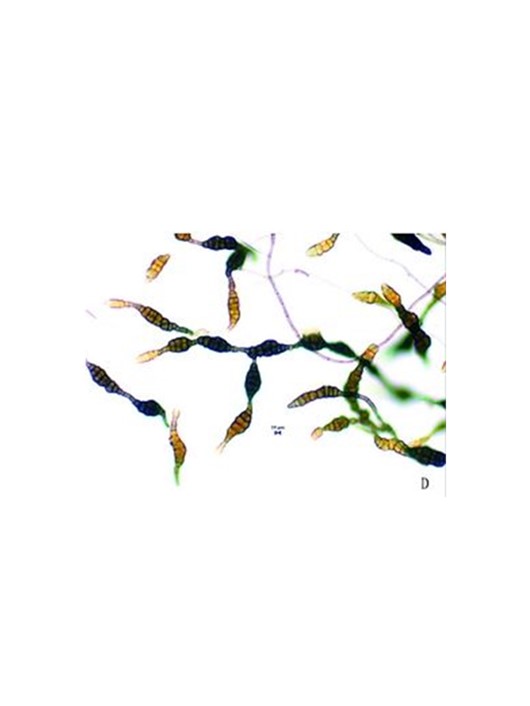 蜡蚧轮枝孢菌